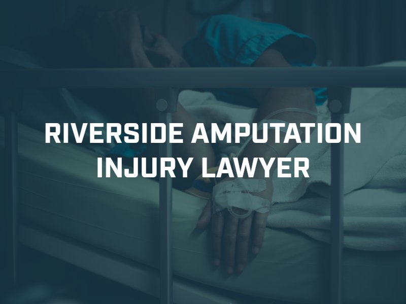 Riverside Amputation Injury Lawyer