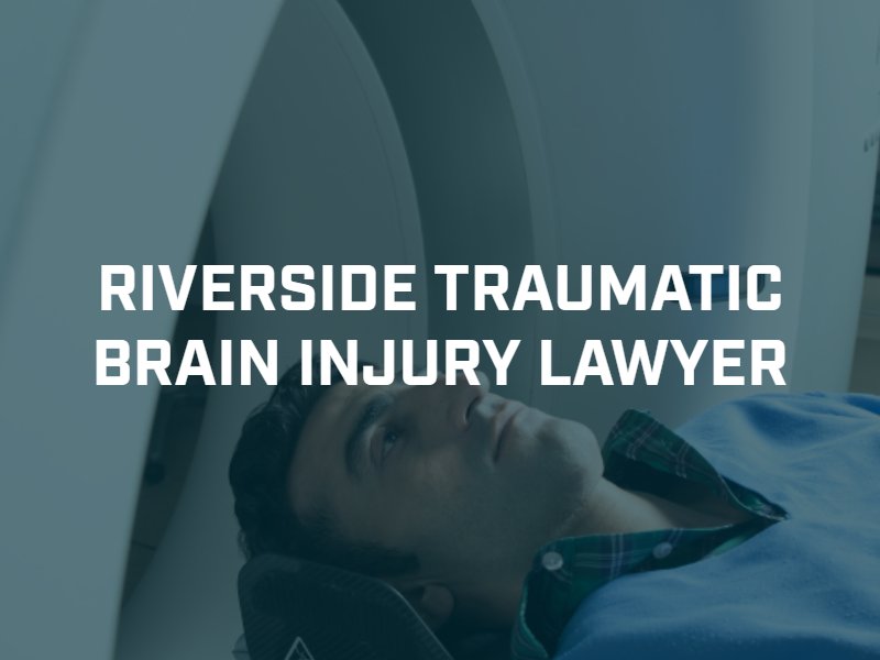 Riverside traumatic brain injury lawyer