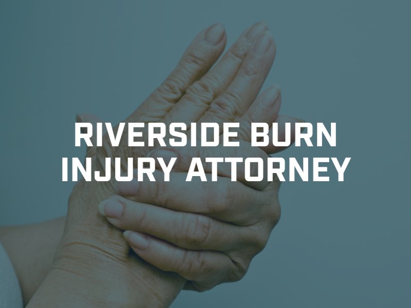 Riverside Burn Injury Lawyer