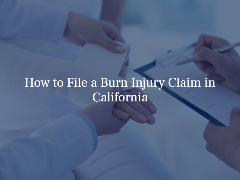 how to file a burn injury claim in california