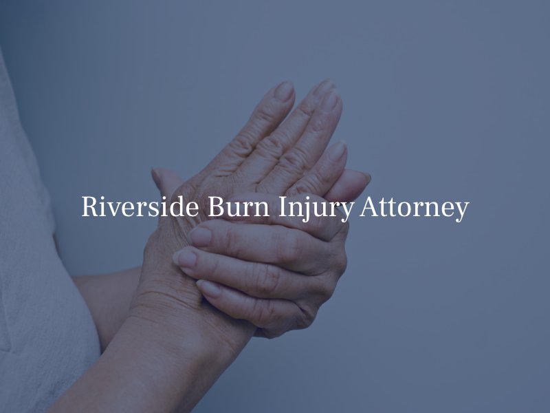 Riverside Burn Injury Attorney